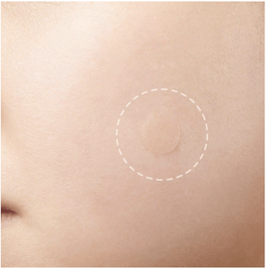 Étiquette de peau et patch d'acné