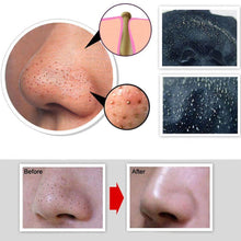 Charger l&#39;image dans la galerie, &quot;blackhead mask&quot; masque pour points noirs - MiniPrixShop.com